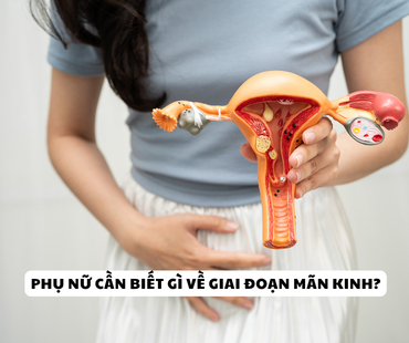 man kinh va nhung dieu can biet