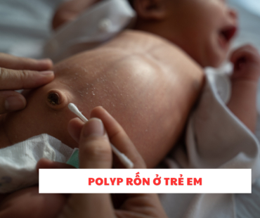polyp ron o tre em
