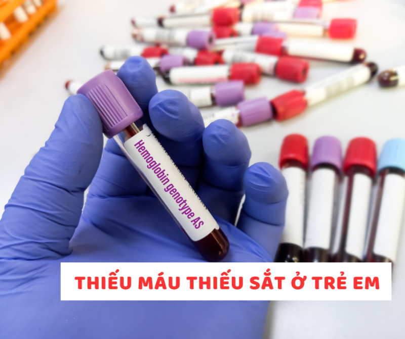 thieu mau thieu sat o tre em  ?? dung de tre cham lon vi thieu vi chat quan trong