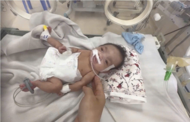 hanh trinh hoi sinh cua be gai sinh cuc non 27 tuan bi bo roi  tu 13kg mong manh den ngay xuat vien khoe manh